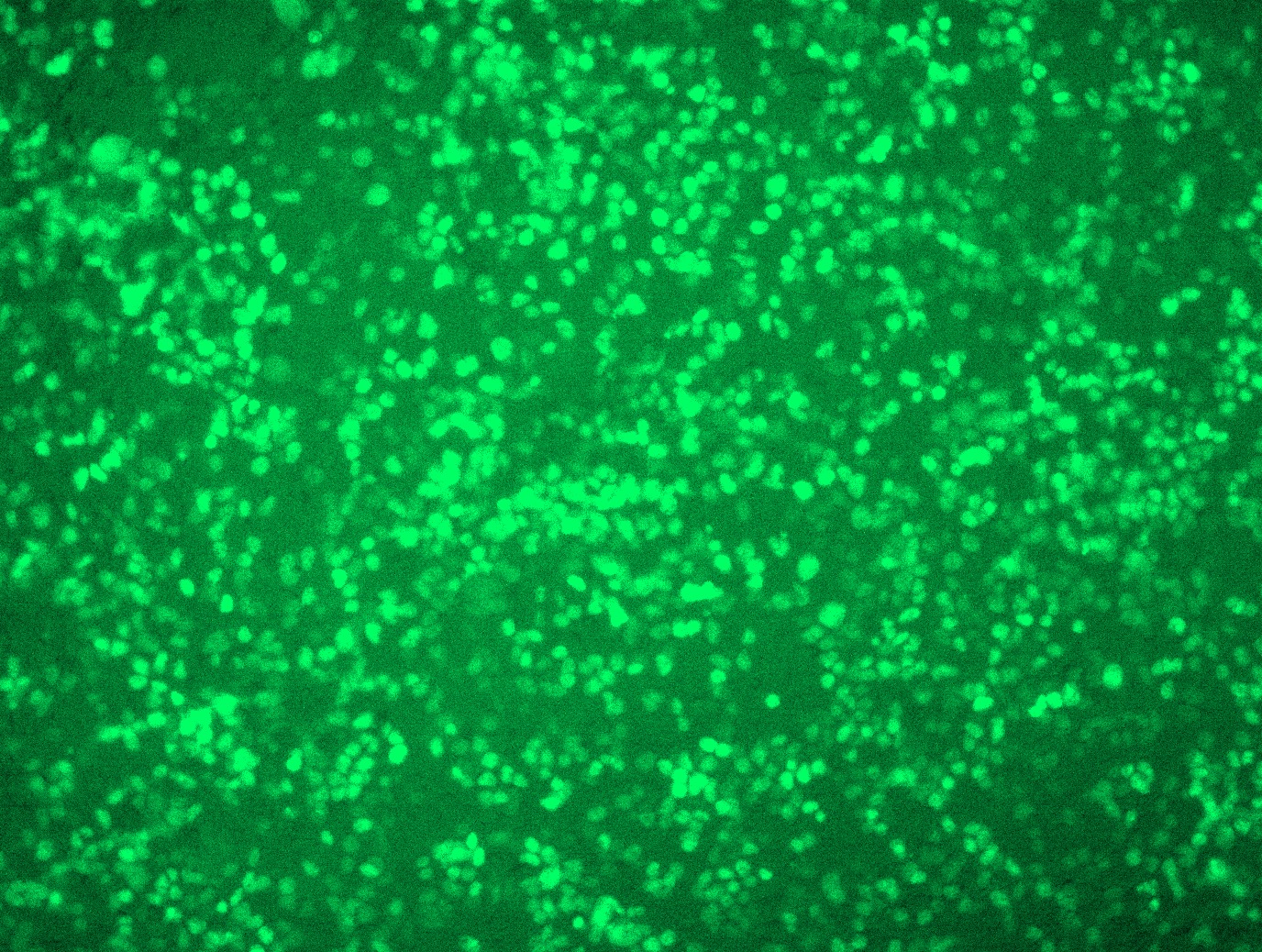 RC210639L4 was used to prepare Lentiviral particles using TR30037 packaging kit. HEK293T cells were transduced with RC210639L4V particle to overexpress human TARDBP-mGFP fusion protein.