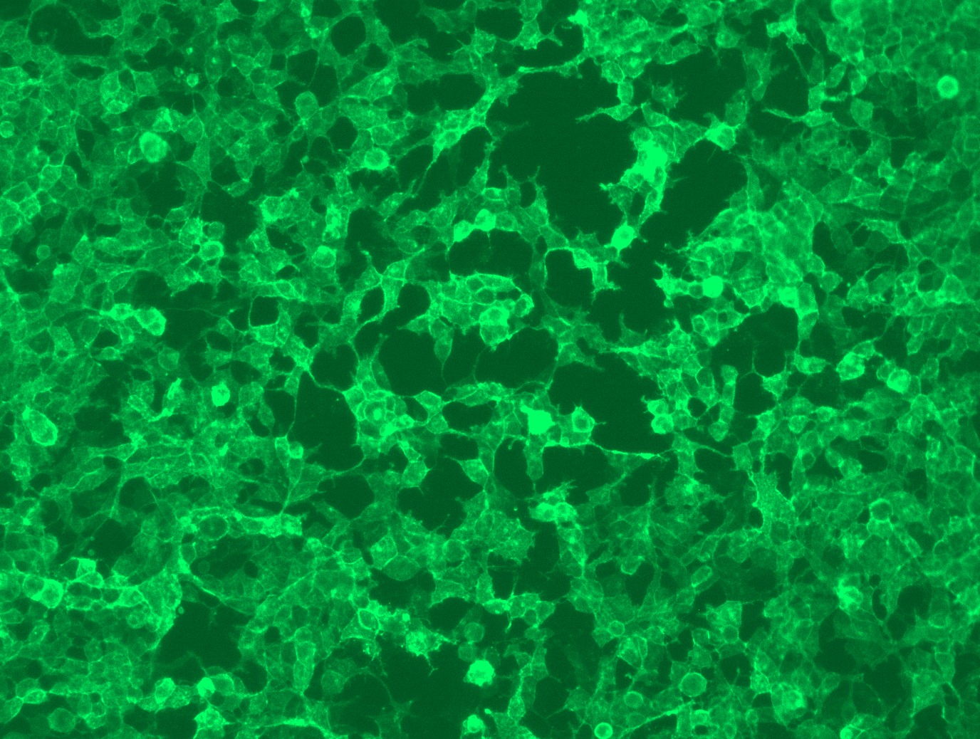<a href = "https://www.origene.com/catalog/cdna-clones/expression-plasmids/rc211856l1-taci-tnfrsf13b-nm-012452-human-tagged-lenti-orf-clone" title="RC211856L1" class="">RC211856L1</a> was used to prepare Lentiviral particles using <a href = "https://www.origene.com/catalog/others/lentiviral-packaging-kits/tr30037-lentiviral-packaging-kits" title="TR30037" class="">TR30037</a> packaging kit. HEK293T cells were transduced with RC211856L1V particle to overexpress human TNFRSF13B-Myc-DDK fusion protein.