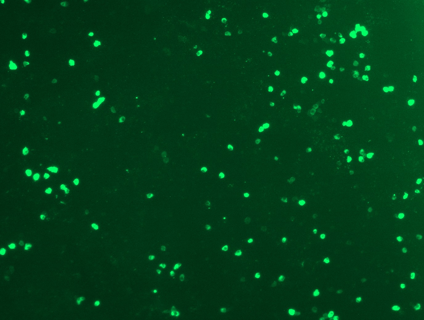 <a href = "https://www.origene.com/catalog/cdna-clones/expression-plasmids/rc213071l1-pd-l1-cd274-nm-014143-human-tagged-lenti-orf-clone" title="RC213071L1" class="">RC213071L1</a> was used to prepare Lentiviral particles using <a href = "https://www.origene.com/catalog/others/lentiviral-packaging-kits/tr30037-lentiviral-packaging-kits" title="TR30037" class="">TR30037</a> packaging kit. HEK293T cells were transduced with RC213071L1V particle to overexpress human CD274-Myc-DDK fusion protein.