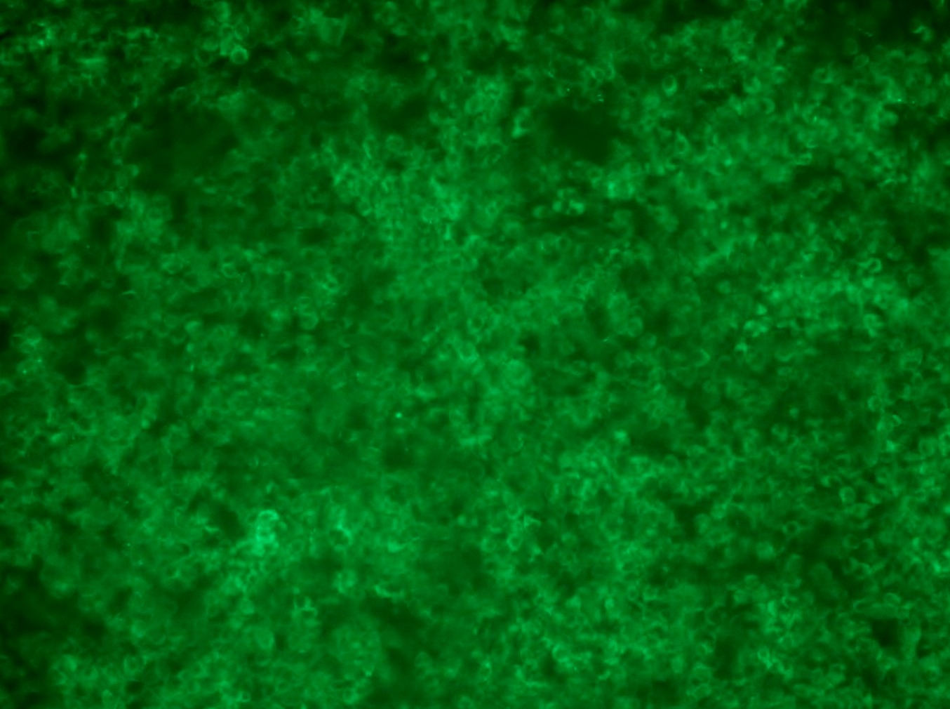 <a href = "https://www.origene.com/catalog/cdna-clones/expression-plasmids/rc213132l4-hsd17b13-nm-178135-human-tagged-lenti-orf-clone" title="RC213132L4" class="">RC213132L4</a> was used to prepare Lentiviral particles using <a href = "https://www.origene.com/catalog/others/lentiviral-packaging-kits/tr30037-lentiviral-packaging-kits" title="TR30037" class="">TR30037</a> packaging kit. HEK293T cells were transduced with RC213132L4V particle to overexpress human HSD17B13-mGFP fusion protein.