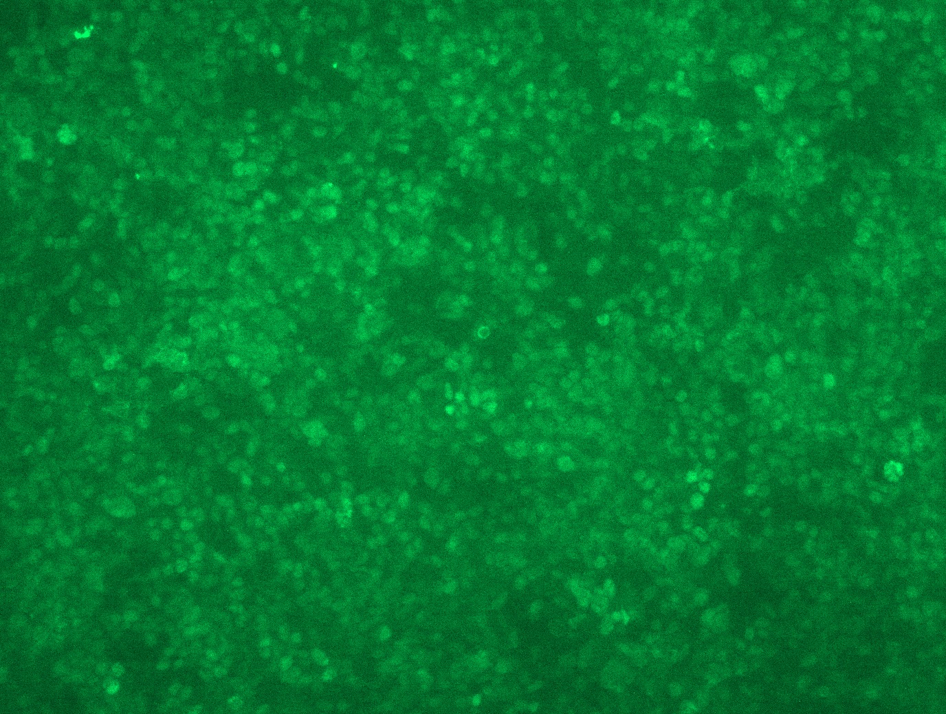 <a href = "https://www.origene.com/catalog/cdna-clones/expression-plasmids/rc213277l3-estrogen-receptor-1-esr1-nm-000125-human-tagged-lenti-orf-clone" title="RC213277L3" class="">RC213277L3</a> was used to prepare Lentiviral particles using <a href = "https://www.origene.com/catalog/others/lentiviral-packaging-kits/tr30037-lentiviral-packaging-kits" title="TR30037" class="">TR30037</a> packaging kit. HEK293T cells were transduced with RC213277L3V particle to overexpress human ESR1-Myc-DDK fusion protein.