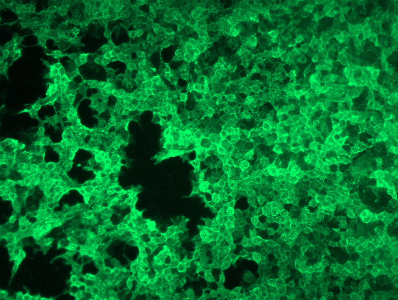 RC215640L1 was used to prepare Lentiviral particles using TR30037 packaging kit. HEK293T cells were transduced with RC215640L1V particle to overexpress human ROR2-Myc-DDK fusion protein.