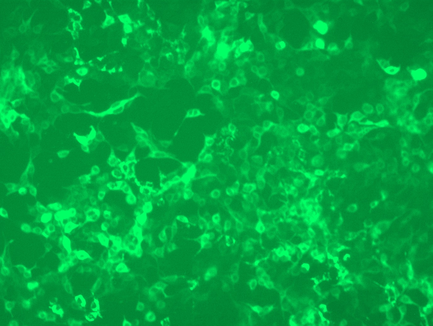 <a href = "https://www.origene.com/catalog/cdna-clones/expression-plasmids/rc216821l3-galnt13-nm-052917-human-tagged-lenti-orf-clone" title="RC216821L3" class="">RC216821L3</a> was used to prepare Lentiviral particles using <a href = "https://www.origene.com/catalog/others/lentiviral-packaging-kits/tr30037-lentiviral-packaging-kits" title="TR30037" class="">TR30037</a> packaging kit. HEK293T cells were transduced with RC216821L3V particle to overexpress human GALNT13-Myc-DDK fusion protein.