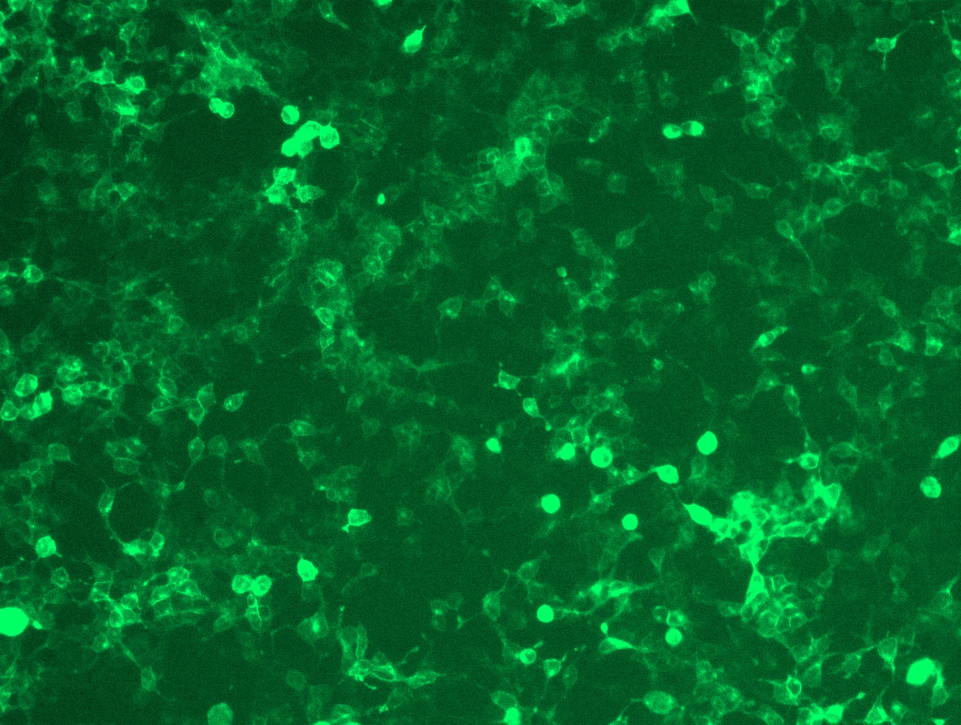 <a href = "https://www.origene.com/catalog/cdna-clones/expression-plasmids/rc216939l2-cd22-nm-001771-human-tagged-lenti-orf-clone" title="RC216939L2" class="">RC216939L2</a> was used to prepare Lentiviral particles using <a href = "https://www.origene.com/catalog/others/lentiviral-packaging-kits/tr30037-lentiviral-packaging-kits" title="TR30037" class="">TR30037</a> packaging kit. HEK293T cells were transduced with RC216939L2V particle to overexpress human CD22-mGFP fusion protein.