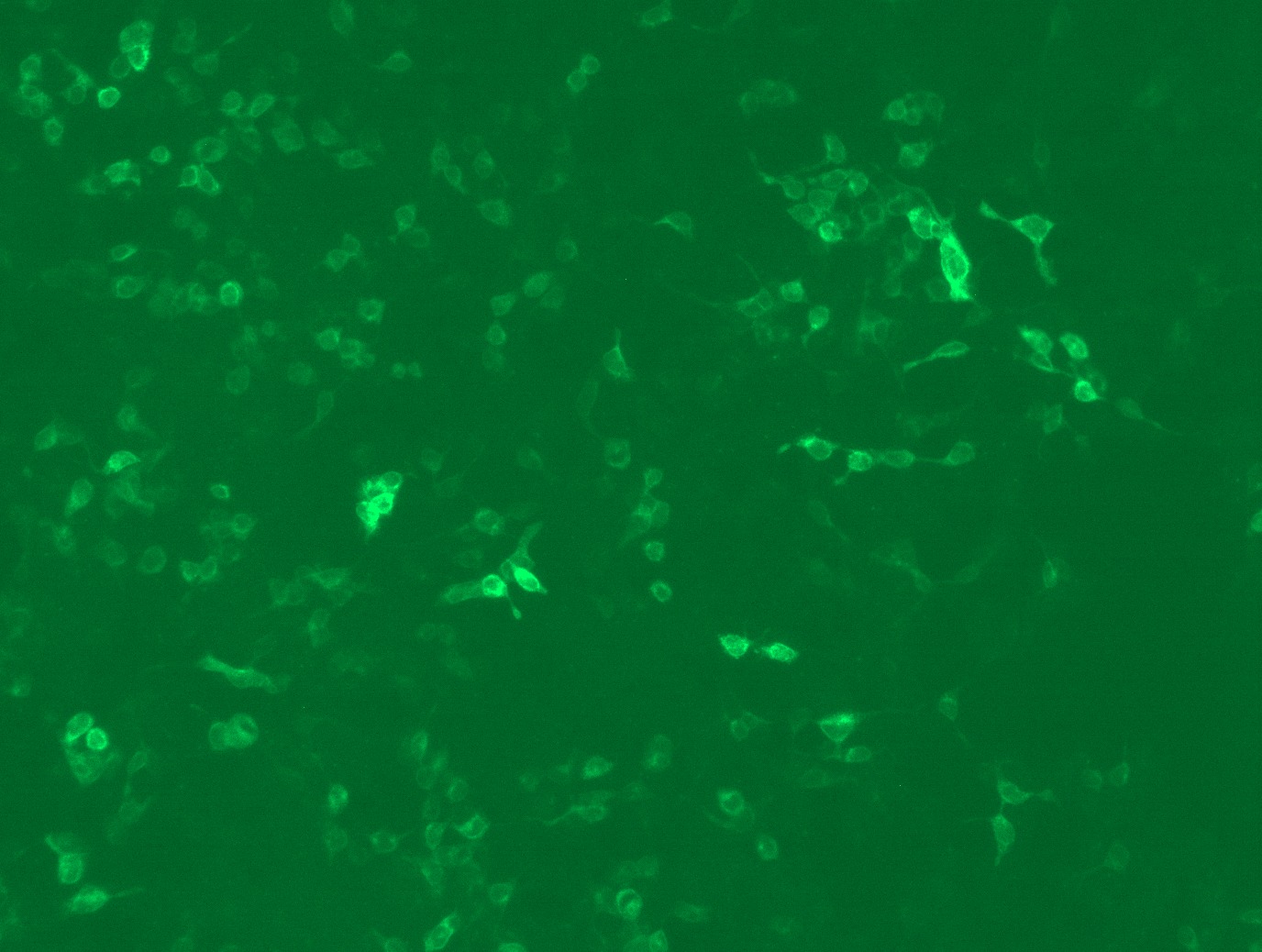 RC218310L3 was used to prepare Lentiviral particles using TR30037 packaging kit. HEK293T cells were transduced with RC218310L3V particle to overexpress human FOLH1-Myc-DDK fusion protein.