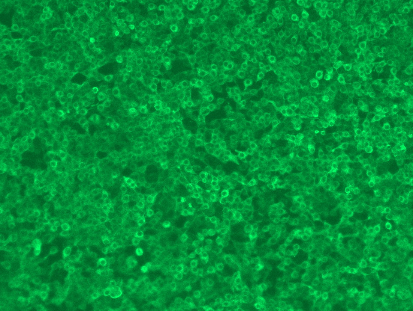 <a href = "https://www.origene.com/catalog/cdna-clones/expression-plasmids/rc220083l3-lpcat1-nm-024830-human-tagged-lenti-orf-clone" title="RC220083L3" class="">RC220083L3</a> was used to prepare Lentiviral particles using <a href = "https://www.origene.com/catalog/others/lentiviral-packaging-kits/tr30037-lentiviral-packaging-kits" title="TR30037" class="">TR30037</a> packaging kit. HEK293T cells were transduced with RC220083L3V particle to overexpress human LPCAT1-Myc-DDK fusion protein.