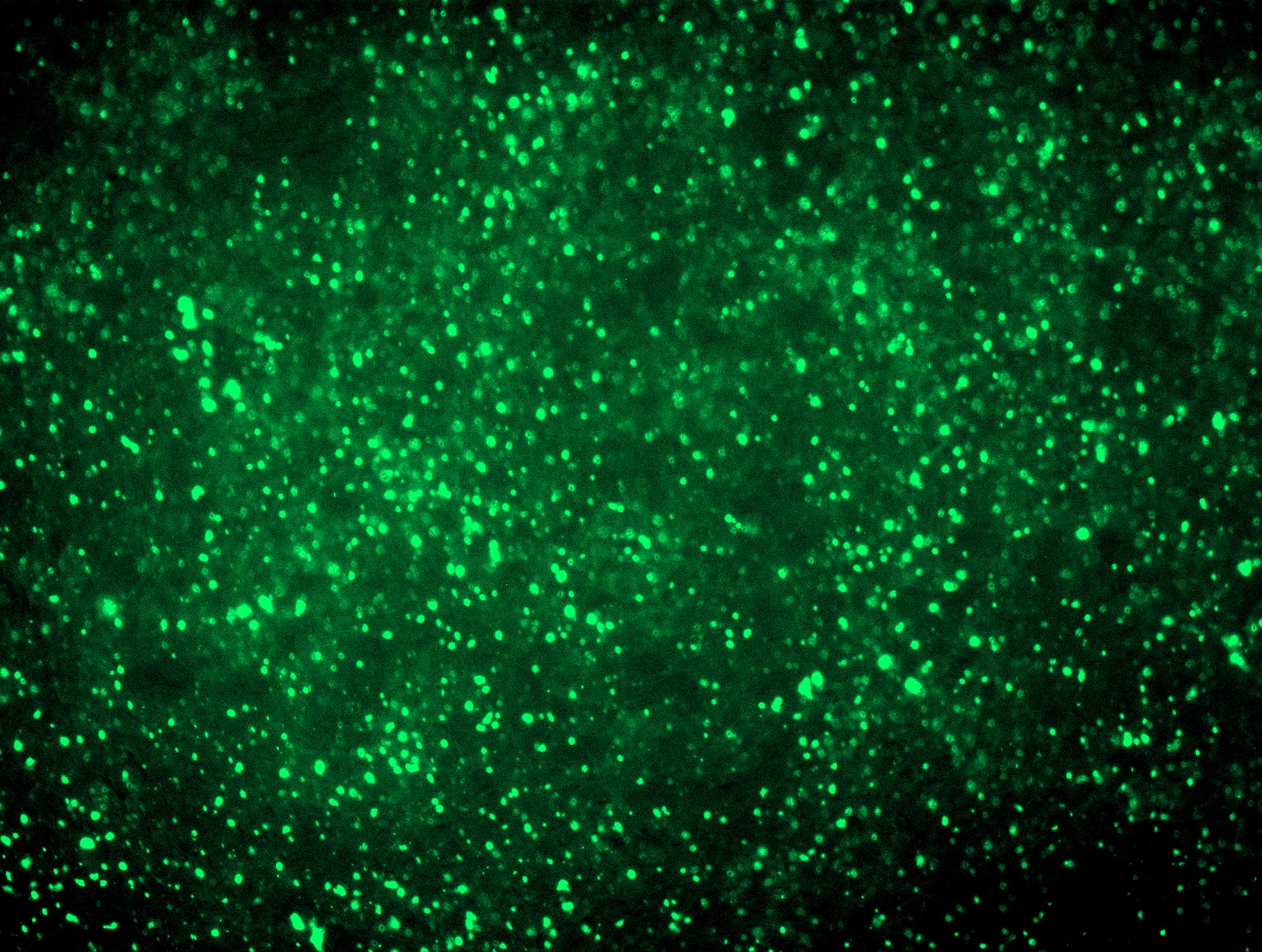 RC221337L2 was used to prepare Lentiviral particles using TR30037 packaging kit. HEK293T cells were transduced with RC221337L2V particle to overexpress human TNFAIP3-mGFP fusion protein.