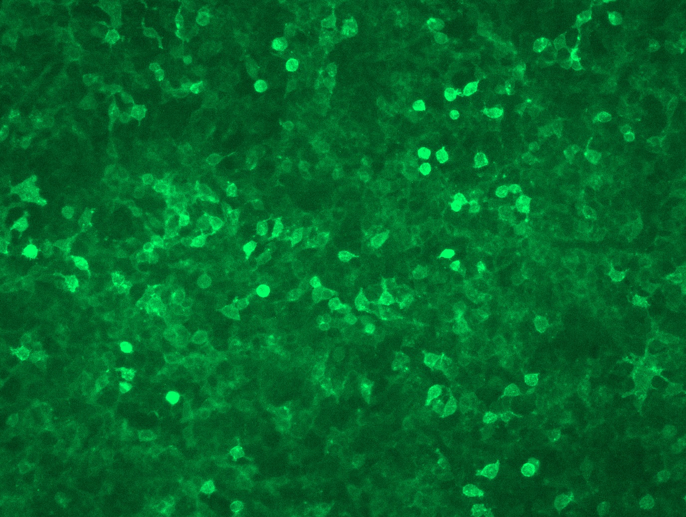 <a href = "https://www.origene.com/catalog/cdna-clones/expression-plasmids/rc221447l1-tigit-nm-173799-human-tagged-lenti-orf-clone" title="RC221447L1" class="">RC221447L1</a> was used to prepare Lentiviral particles using <a href = "https://www.origene.com/catalog/others/lentiviral-packaging-kits/tr30037-lentiviral-packaging-kits" title="TR30037" class="">TR30037</a> packaging kit. HEK293T cells were transduced with RC221447L1V particle to overexpress human TIGIT-Myc-DDK fusion protein.