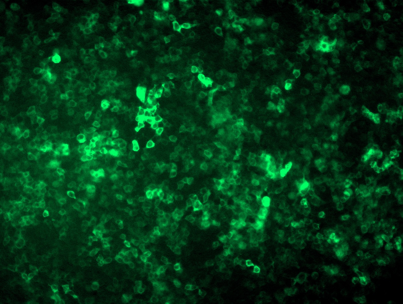 <a href = "https://www.origene.com/catalog/cdna-clones/expression-plasmids/rc221628l4-bach1-nm-206866-human-tagged-lenti-orf-clone" title="RC221628L4" class="">RC221628L4</a> was used to prepare Lentiviral particles using <a href = "https://www.origene.com/catalog/others/lentiviral-packaging-kits/tr30037-lentiviral-packaging-kits" title="TR30037" class="">TR30037</a> packaging kit. HEK293T cells were transduced with RC221628L4V particle to overexpress human BACH1-mGFP fusion protein.