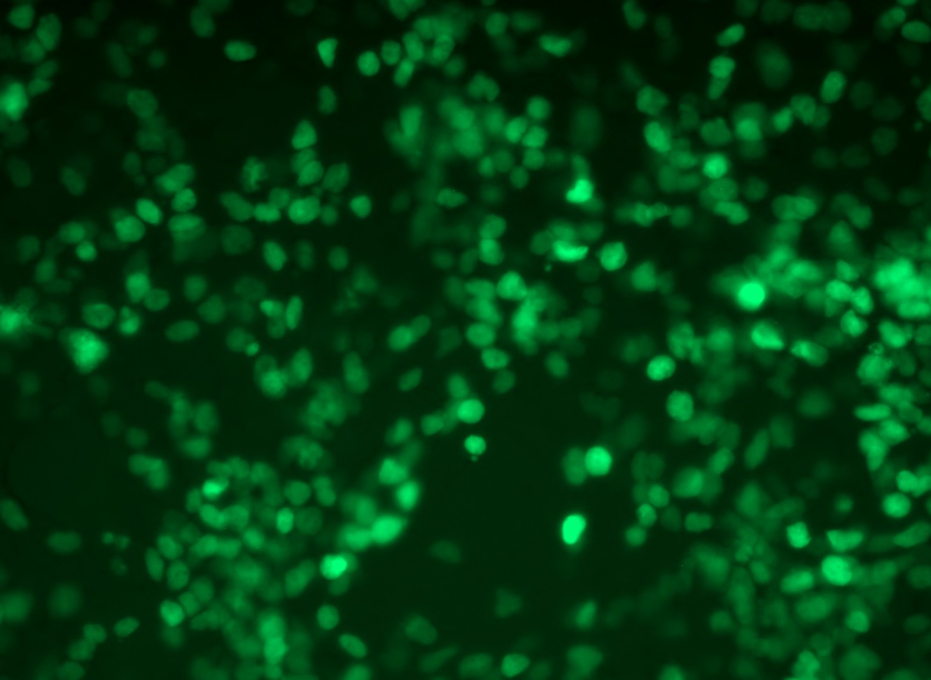 RC224762L2 was used to prepare Lentiviral particles using TR30037 packaging kit. HEK293T cells were transduced with RC224762L2V particle to overexpress human NKX6-1-mGFP fusion protein. RC224762L2 was used to prepare Lentiviral particles using TR30037 packaging kit. HEK293T cells were transduced with RC224762L2V particle to overexpress human NKX6-1-mGFP fusion protein.
