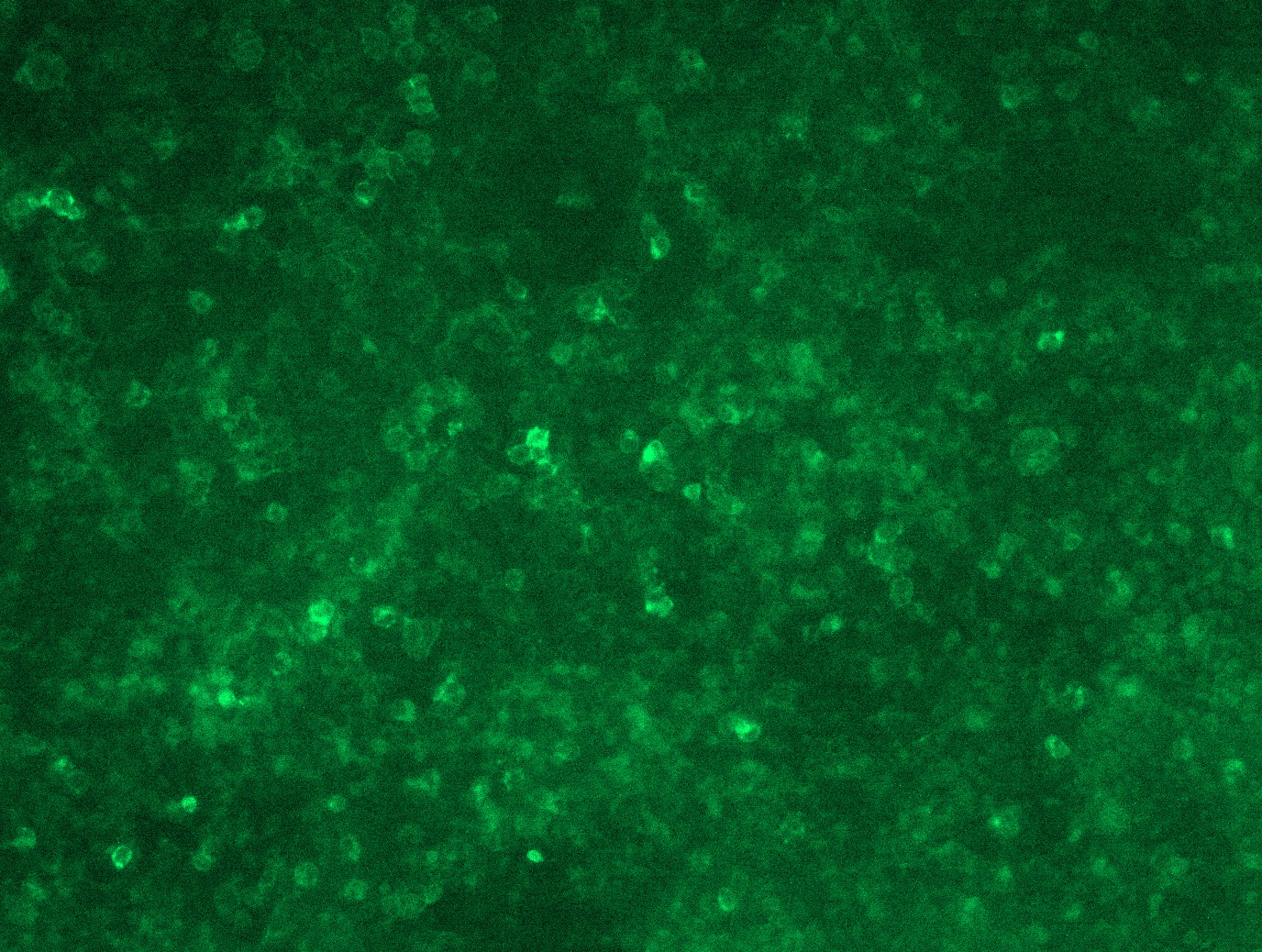 RC225799L3 was used to prepare Lentiviral particles using TR30037 packaging kit. HEK293T cells were transduced with RC225799L3V particle to overexpress human CD36-Myc-DDK fusion protein.