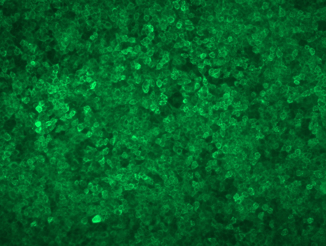 RC225843L3 was used to prepare Lentiviral particles using TR30037 packaging kit. HEK293T cells were transduced with RC225843L3V particle to overexpress human PLXNA4-Myc-DDK fusion protein.