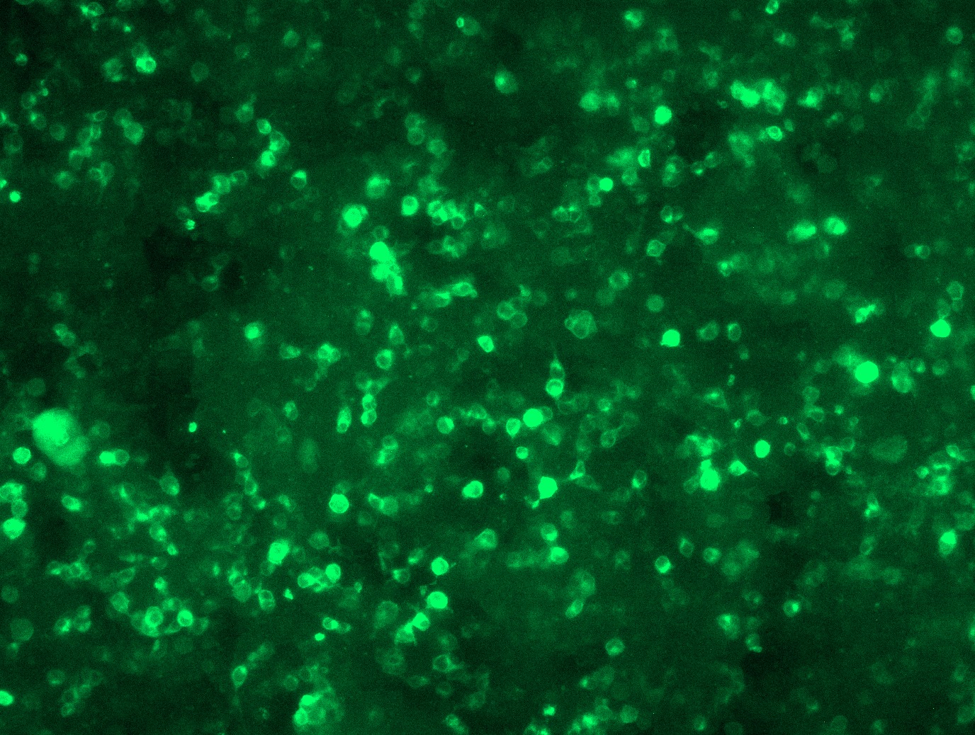 RC225845L1 was used to prepare Lentiviral particles using TR30037 packaging kit. HEK293T cells were transduced with RC225845L1V particle to overexpress human SLC39A14-Myc-DDK fusion protein.