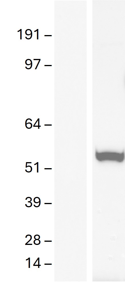 Western blot validation of overexpression lysate (Cat# <a href = "https://www.origene.com/catalog/proteins/over-expression-lysates/ly400713-desmin-des-nm-001927-human-over-expression-lysate" title="LY400713" class="">LY400713</a>) using anti-DDK antibody (Cat# <a href = "https://www.origene.com/catalog/antibodies/tag-antibodies/ta592569-ddk-rabbit-monoclonal-antibody-recognizing-both-n-and-c-terminal-tags" title="TA592569" class="">TA592569</a>). Left: Cell lysates from un-transfected HEK293T cells; Right: Cell lysates from HEK293T cells transfected with <a href = "https://www.origene.com/catalog/cdna-clones/expression-plasmids/rc205685-desmin-des-nm-001927-human-tagged-orf-clone" title="RC205685" class="">RC205685</a> using transfection reagent MegaTran 2.0 (Cat# <a href = "https://www.origene.com/catalog/others/transfection-reagents/tt210002-megatran-20-plasmid-dna-transfection-reagent-05-ml" title="TT210002" class="">TT210002</a>).