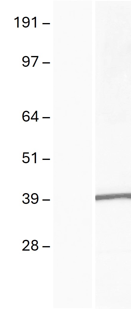 Western blot validation of overexpression lysate (Cat# LY405476) using anti-DDK antibody (Cat# <a href = "https://www.origene.com/catalog/antibodies/tag-antibodies/ta180144-ddk-flag-mouse-monoclonal-antibody-clone-oti11c3" title="TA180144" class="">TA180144</a>). Left: Cell lysates from un-transfected HEK293T cells; Right: Cell lysates from HEK293T cells transfected with <a href = "https://www.origene.com/catalog/cdna-clones/expression-plasmids/rc220664-lclat1-nm-182551-human-tagged-orf-clone" title="RC220664" class="">RC220664</a> using transfection reagent MegaTran 2.0 (Cat# <a href = "https://www.origene.com/catalog/others/transfection-reagents/tt210002-megatran-20-plasmid-dna-transfection-reagent-05-ml" title="TT210002" class="">TT210002</a>).