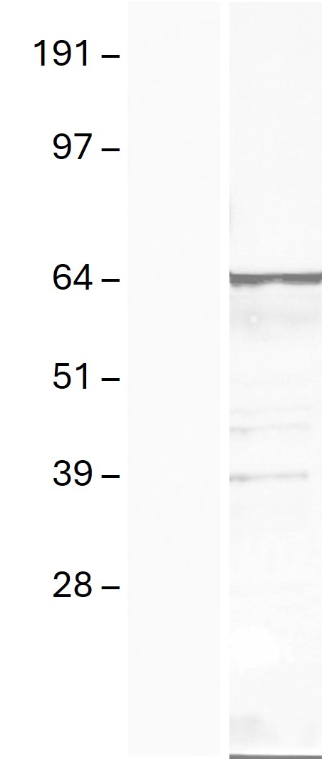 Western blot validation of overexpression lysate (Cat# <a href = "https://www.origene.com/catalog/proteins/over-expression-lysates/ly407798-ciks-traf3ip2-nm-147686-human-over-expression-lysate" title="LY407798" class="">LY407798</a>) using anti-DDK antibody (Cat# <a href = "https://www.origene.com/catalog/antibodies/tag-antibodies/ta180144-ddk-flag-mouse-monoclonal-antibody-clone-oti11c3" title="TA180144" class="">TA180144</a>). Left: Cell lysates from un-transfected HEK293T cells; Right: Cell lysates from HEK293T cells transfected with RC201106 using transfection reagent MegaTran 2.0 (Cat# <a href = "https://www.origene.com/catalog/others/transfection-reagents/tt210002-megatran-20-plasmid-dna-transfection-reagent-05-ml" title="TT210002" class="">TT210002</a>).