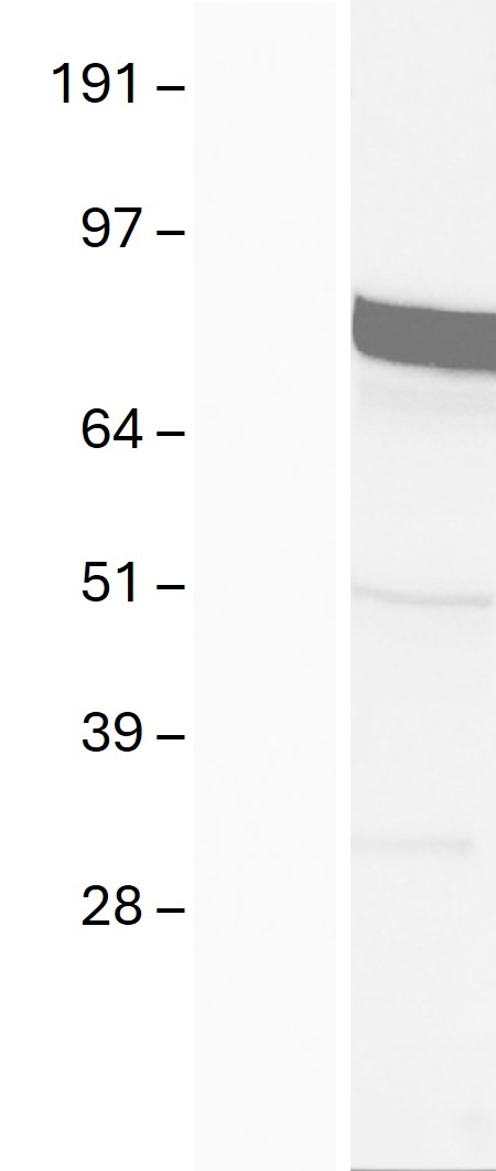 Western blot validation of overexpression lysate (Cat# LY409071) using anti-DDK antibody (Cat# <a href = "https://www.origene.com/catalog/antibodies/tag-antibodies/ta180144-ddk-flag-mouse-monoclonal-antibody-clone-oti11c3" title="TA180144" class="">TA180144</a>). Left: Cell lysates from un-transfected HEK293T cells; Right: Cell lysates from HEK293T cells transfected with <a href = "https://www.origene.com/catalog/cdna-clones/expression-plasmids/rc221505-dach1-nm-080759-human-tagged-orf-clone" title="RC221505" class="">RC221505</a> using transfection reagent MegaTran 2.0 (Cat# <a href = "https://www.origene.com/catalog/others/transfection-reagents/tt210002-megatran-20-plasmid-dna-transfection-reagent-05-ml" title="TT210002" class="">TT210002</a>).