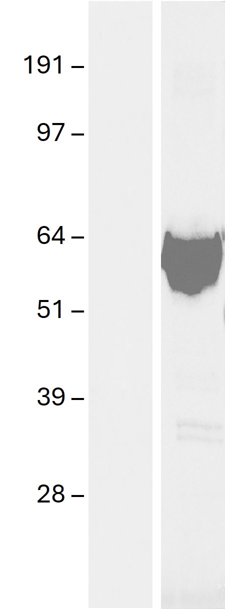 Western blot validation of overexpression lysate (Cat# <a href = "https://www.origene.com/catalog/proteins/over-expression-lysates/ly415014-epm2aip1-nm-014805-human-over-expression-lysate" title="LY415014" class="">LY415014</a>) using anti-DDK antibody (Cat# <a href = "https://www.origene.com/catalog/antibodies/tag-antibodies/ta180144-ddk-flag-mouse-monoclonal-antibody-clone-oti11c3" title="TA180144" class="">TA180144</a>). Left: Cell lysates from un-transfected HEK293T cells; Right: Cell lysates from HEK293T cells transfected with <a href = "https://www.origene.com/catalog/cdna-clones/expression-plasmids/rc209239-epm2aip1-nm-014805-human-tagged-orf-clone" title="RC209239" class="">RC209239</a>  using transfection reagent MegaTran 2.0 (Cat# <a href = "https://www.origene.com/catalog/others/transfection-reagents/tt210002-megatran-20-plasmid-dna-transfection-reagent-05-ml" title="TT210002" class="">TT210002</a>).