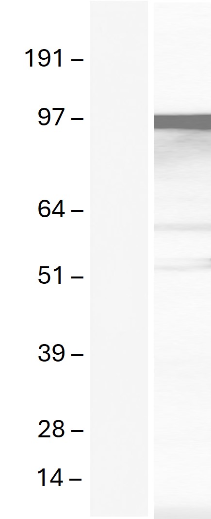 Western blot validation of overexpression lysate (Cat# <a href = "https://www.origene.com/catalog/proteins/over-expression-lysates/ly422544-tnrc6b-nm-001024843-human-over-expression-lysate" title="LY422544" class="">LY422544</a>) using anti-DDK antibody (Cat# <a href = "https://www.origene.com/catalog/antibodies/tag-antibodies/ta180144-ddk-flag-mouse-monoclonal-antibody-clone-oti11c3" title="TA180144" class="">TA180144</a>). Left: Cell lysates from un-transfected HEK293T cells; Right: Cell lysates from HEK293T cells transfected with <a href = "https://www.origene.com/catalog/cdna-clones/expression-plasmids/rc206220-tnrc6b-nm-001024843-human-tagged-orf-clone" title="RC206220" class="">RC206220</a> using transfection reagent MegaTran 2.0 (Cat# <a href = "https://www.origene.com/catalog/others/transfection-reagents/tt210002-megatran-20-plasmid-dna-transfection-reagent-05-ml" title="TT210002" class="">TT210002</a>).