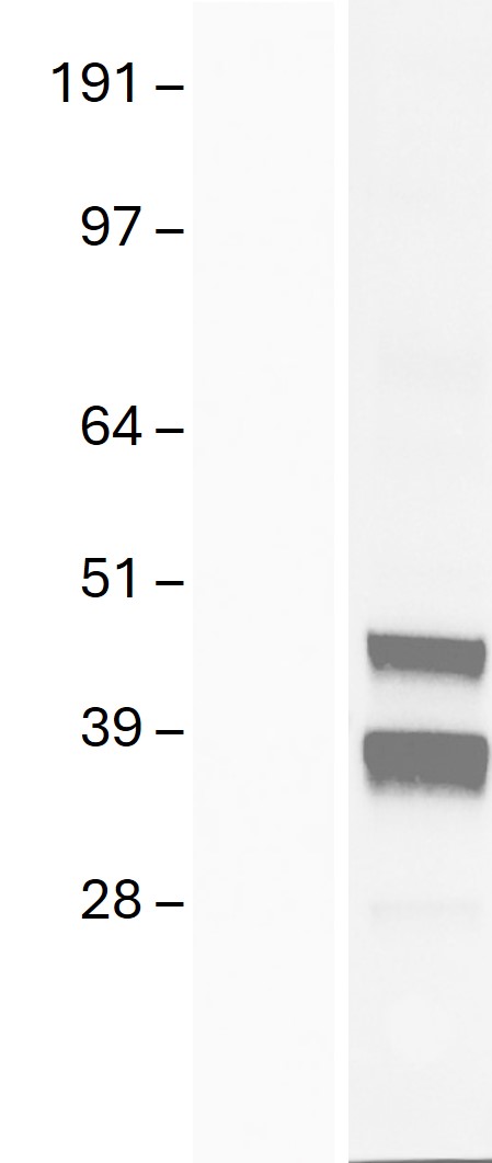 Western blot validation of overexpression lysate (Cat# <a href = "https://www.origene.com/catalog/proteins/over-expression-lysates/ly422595-dhlag-cd74-nm-001025159-human-over-expression-lysate" title="LY422595" class="">LY422595</a>) using anti-DDK antibody (Cat# <a href = "https://www.origene.com/catalog/antibodies/tag-antibodies/ta180144-ddk-flag-mouse-monoclonal-antibody-clone-oti11c3" title="TA180144" class="">TA180144</a>). Left: Cell lysates from un-transfected HEK293T cells; Right: Cell lysates from HEK293T cells transfected with <a href = "https://www.origene.com/catalog/cdna-clones/expression-plasmids/rc212964-dhlag-cd74-nm-001025159-human-tagged-orf-clone" title="RC212964" class="">RC212964</a> using transfection reagent MegaTran 2.0 (Cat# <a href = "https://www.origene.com/catalog/others/transfection-reagents/tt210002-megatran-20-plasmid-dna-transfection-reagent-05-ml" title="TT210002" class="">TT210002</a>).