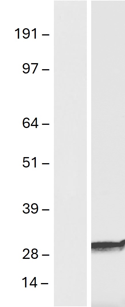 Western blot validation of overexpression lysate (Cat# <a href = "https://www.origene.com/catalog/proteins/over-expression-lysates/ly424488-gsta2-nm-000846-human-over-expression-lysate" title="LY424488" class="">LY424488</a>) using anti-DDK antibody (Cat# <a href = "https://www.origene.com/catalog/antibodies/tag-antibodies/ta180144-ddk-flag-mouse-monoclonal-antibody-clone-oti11c3" title="TA180144" class="">TA180144</a>). Left: Cell lysates from un-transfected HEK293T cells; Right: Cell lysates from HEK293T cells transfected with RC202479 using transfection reagent MegaTran 2.0 (Cat# <a href = "https://www.origene.com/catalog/others/transfection-reagents/tt210002-megatran-20-plasmid-dna-transfection-reagent-05-ml" title="TT210002" class="">TT210002</a>).