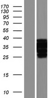 Western blot validation of overexpression lysate (Cat# <a href = "https://www.origene.com/catalog/proteins/over-expression-lysates/ly404097-duba2-otud6a-nm-207320-human-over-expression-lysate" title="LY404097" class="">LY404097</a>) using anti-DDK antibody (Cat# <a href = "https://www.origene.com/catalog/antibodies/tag-antibodies/ta50011-100-clone-oti4c5-anti-ddk-flag-monoclonal-antibody" title="TA50011-100" class="">TA50011-100</a>). Left: Cell lysates from un-transfected HEK293T cells; Right: Cell lysates from HEK293T cells transfected with <a href = "https://www.origene.com/catalog/cdna-clones/expression-plasmids/rc215651-duba2-otud6a-nm-207320-human-tagged-orf-clone" title="RC215651" class="">RC215651</a> using transfection reagent MegaTran 2.0 (Cat# <a href = "https://www.origene.com/catalog/others/transfection-reagents/tt210002-megatran-20-plasmid-dna-transfection-reagent-05-ml" title="TT210002" class="">TT210002</a>).
