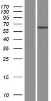 Western blot validation of overexpression lysate (Cat# <a href = "https://www.origene.com/catalog/proteins/over-expression-lysates/ly410970-zcchc4-nm-024936-human-over-expression-lysate" title="LY410970" class="">LY410970</a>) using anti-DDK antibody (Cat# <a href = "https://www.origene.com/catalog/antibodies/tag-antibodies/ta50011-100-clone-oti4c5-anti-ddk-flag-monoclonal-antibody" title="TA50011-100" class="">TA50011-100</a>). Left: Cell lysates from un-transfected HEK293T cells; Right: Cell lysates from HEK293T cells transfected with <a href = "https://www.origene.com/catalog/cdna-clones/expression-plasmids/rc219909-zcchc4-nm-024936-human-tagged-orf-clone" title="RC219909" class="">RC219909</a> using transfection reagent MegaTran 2.0 (Cat# <a href = "https://www.origene.com/catalog/others/transfection-reagents/tt210002-megatran-20-plasmid-dna-transfection-reagent-05-ml" title="TT210002" class="">TT210002</a>).