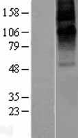 Western blot validation of overexpression lysate (Cat# LY401542) using anti-DDK antibody (Cat# TA50011-100). Left: Cell lysates from un-transfected HEK293T cells; Right: Cell lysates from HEK293T cells transfected with RC214063 using transfection reagent MegaTran 2.0 (Cat# TT210002).