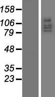 Western blot validation of overexpression lysate (Cat# LY417781) using anti-DDK antibody (Cat# <a href = "https://www.origene.com/catalog/antibodies/tag-antibodies/ta50011-100-clone-oti4c5-anti-ddk-flag-monoclonal-antibody" title="TA50011-100" class="">TA50011-100</a>). Left: Cell lysates from un-transfected HEK293T cells; Right: Cell lysates from HEK293T cells transfected with <a href = "https://www.origene.com/catalog/cdna-clones/expression-plasmids/rc213793-dlg5-nm-004747-human-tagged-orf-clone" title="RC213793" class="">RC213793</a> using transfection reagent MegaTran 2.0 (Cat# <a href = "https://www.origene.com/catalog/others/transfection-reagents/tt210002-megatran-20-plasmid-dna-transfection-reagent-05-ml" title="TT210002" class="">TT210002</a>).
