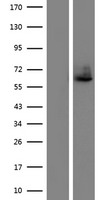 Western blot validation of overexpression lysate (Cat# LY415845) using anti-DDK antibody (Cat# TA50011-100). Left: Cell lysates from un-transfected HEK293T cells; Right: Cell lysates from HEK293T cells transfected with RC220452 using transfection reagent MegaTran 2.0 (Cat# TT210002).