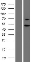 Western blot validation of overexpression lysate (Cat# LY414458) using anti-DDK antibody (Cat# TA50011-100). Left: Cell lysates from un-transfected HEK293T cells; Right: Cell lysates from HEK293T cells transfected with RC220331 using transfection reagent MegaTran 2.0 (Cat# TT210002).