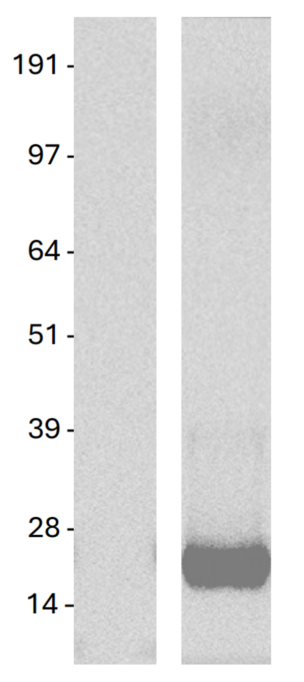 KRAS (G12V) Mutant Human Over-expression Lysate