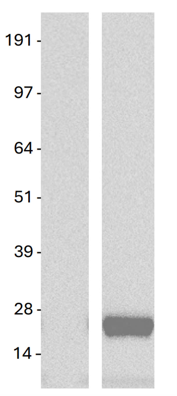 KRAS (G12D) Mutant Human Over-expression Lysate