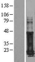 Western blot validation of overexpression lysate (Cat# LY402838) using anti-DDK antibody (Cat# <a href = "https://www.origene.com/catalog/antibodies/tag-antibodies/ta50011-100-clone-oti4c5-anti-ddk-flag-monoclonal-antibody" title="TA50011-100" class="">TA50011-100</a>). Left: Cell lysates from un-transfected HEK293T cells; Right: Cell lysates from HEK293T cells transfected with <a href = "https://www.origene.com/catalog/cdna-clones/expression-plasmids/rc204459-gage7-nm-021123-human-tagged-orf-clone" title="RC204459" class="">RC204459</a> using transfection reagent MegaTran 2.0 (Cat# <a href = "https://www.origene.com/catalog/others/transfection-reagents/tt210002-megatran-20-plasmid-dna-transfection-reagent-05-ml" title="TT210002" class="">TT210002</a>).