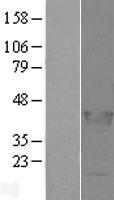 Western blot validation of overexpression lysate (Cat# <a href = "https://www.origene.com/catalog/proteins/over-expression-lysates/ly403518-lcorl-nm-153686-human-over-expression-lysate" title="LY403518" class="">LY403518</a>) using anti-DDK antibody (Cat# <a href = "https://www.origene.com/catalog/antibodies/tag-antibodies/ta50011-100-clone-oti4c5-anti-ddk-flag-monoclonal-antibody" title="TA50011-100" class="">TA50011-100</a>). Left: Cell lysates from un-transfected HEK293T cells; Right: Cell lysates from HEK293T cells transfected with <a href = "https://www.origene.com/catalog/cdna-clones/expression-plasmids/rc207306-lcorl-nm-153686-human-tagged-orf-clone" title="RC207306" class="">RC207306</a> using transfection reagent MegaTran 2.0 (Cat# <a href = "https://www.origene.com/catalog/others/transfection-reagents/tt210002-megatran-20-plasmid-dna-transfection-reagent-05-ml" title="TT210002" class="">TT210002</a>).