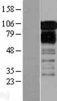 Western blot validation of overexpression lysate (Cat# LY402028) using anti-DDK antibody (Cat# <a href = "https://www.origene.com/catalog/antibodies/tag-antibodies/ta50011-100-clone-oti4c5-anti-ddk-flag-monoclonal-antibody" title="TA50011-100" class="">TA50011-100</a>). Left: Cell lysates from un-transfected HEK293T cells; Right: Cell lysates from HEK293T cells transfected with <a href = "https://www.origene.com/catalog/cdna-clones/expression-plasmids/rc200253-zfpl1-nm-006782-human-tagged-orf-clone" title="RC200253" class="">RC200253</a> using transfection reagent MegaTran 2.0 (Cat# <a href = "https://www.origene.com/catalog/others/transfection-reagents/tt210002-megatran-20-plasmid-dna-transfection-reagent-05-ml" title="TT210002" class="">TT210002</a>).
