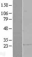 Glutathione S Transferase alpha 1 (GSTA1) (NM_145740) Human Tagged ORF Clone | RC208750 | OriGene Technologies Inc. Glutathione S Transferase alpha 1 (GSTA1) (NM_145740) Human Tagged ORF Clone | RC208750 | OriGene Technologies Inc.