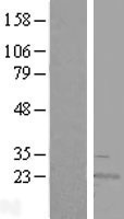 Western blot validation of overexpression lysate (Cat# LY407359) using anti-DDK antibody (Cat# <a href = "https://www.origene.com/catalog/antibodies/tag-antibodies/ta50011-100-clone-oti4c5-anti-ddk-flag-monoclonal-antibody" title="TA50011-100" class="">TA50011-100</a>). Left: Cell lysates from un-transfected HEK293T cells; Right: Cell lysates from HEK293T cells transfected with <a href = "https://www.origene.com/catalog/cdna-clones/expression-plasmids/rc202369-rwdd4a-rwdd4-nm-152682-human-tagged-orf-clone" title="RC202369" class="">RC202369</a> using transfection reagent MegaTran 2.0 (Cat# <a href = "https://www.origene.com/catalog/others/transfection-reagents/tt210002-megatran-20-plasmid-dna-transfection-reagent-05-ml" title="TT210002" class="">TT210002</a>).