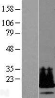 Western blot validation of overexpression lysate (Cat# LY415508) using anti-DDK antibody (Cat# TA50011-100). Left: Cell lysates from un-transfected HEK293T cells; Right: Cell lysates from HEK293T cells transfected with RC201879 using transfection reagent MegaTran 2.0 (Cat# TT210002).