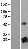 Western blot validation of overexpression lysate (Cat# LY415907) using anti-DDK antibody (Cat# TA50011-100). Left: Cell lysates from un-transfected HEK293T cells; Right: Cell lysates from HEK293T cells transfected with RC221284 using transfection reagent MegaTran 2.0 (Cat# TT210002).