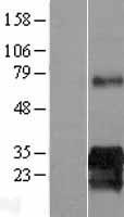 Western blot validation of overexpression lysate (Cat# LY415070) using anti-DDK antibody (Cat# TA50011-100). Left: Cell lysates from un-transfected HEK293T cells; Right: Cell lysates from HEK293T cells transfected with RC209240 using transfection reagent MegaTran 2.0 (Cat# TT210002).