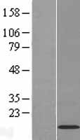 Western blot validation of overexpression lysate (Cat# LY408963) using anti-DDK antibody (Cat# <a href = "https://www.origene.com/catalog/antibodies/tag-antibodies/ta50011-100-clone-oti4c5-anti-ddk-flag-monoclonal-antibody" title="TA50011-100" class="">TA50011-100</a>). Left: Cell lysates from un-transfected HEK293T cells; Right: Cell lysates from HEK293T cells transfected with <a href = "https://www.origene.com/catalog/cdna-clones/expression-plasmids/rc211096-c11orf52-nm-080659-human-tagged-orf-clone" title="RC211096" class="">RC211096</a> using transfection reagent MegaTran 2.0 (Cat# <a href = "https://www.origene.com/catalog/others/transfection-reagents/tt210002-megatran-20-plasmid-dna-transfection-reagent-05-ml" title="TT210002" class="">TT210002</a>).