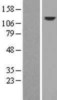 Western blot validation of overexpression lysate (Cat# LY419641) using anti-DDK antibody (Cat# <a href = "https://www.origene.com/catalog/antibodies/tag-antibodies/ta50011-100-clone-oti4c5-anti-ddk-flag-monoclonal-antibody" title="TA50011-100" class="">TA50011-100</a>). Left: Cell lysates from un-transfected HEK293T cells; Right: Cell lysates from HEK293T cells transfected with <a href = "https://www.origene.com/catalog/cdna-clones/expression-plasmids/rc215641-drp2-nm-001939-human-tagged-orf-clone" title="RC215641" class="">RC215641</a> using transfection reagent MegaTran 2.0 (Cat# <a href = "https://www.origene.com/catalog/others/transfection-reagents/tt210002-megatran-20-plasmid-dna-transfection-reagent-05-ml" title="TT210002" class="">TT210002</a>).