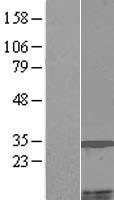 Western blot validation of overexpression lysate (Cat# LY423294) using anti-DDK antibody (Cat# TA50011-100). Left: Cell lysates from un-transfected HEK293T cells; Right: Cell lysates from HEK293T cells transfected with RC219552 using transfection reagent MegaTran 2.0 (Cat# TT210002). Western blot validation of overexpression lysate (Cat# LY423294) using anti-DDK antibody (Cat# TA50011-100). Left: Cell lysates from un-transfected HEK293T cells; Right: Cell lysates from HEK293T cells transfected with RC219552 using transfection reagent MegaTran 2.0 (Cat# TT210002).