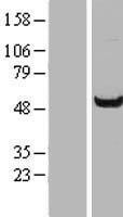 Western blot validation of overexpression lysate (Cat# LY415526) using anti-DDK antibody (Cat# TA50011-100). Left: Cell lysates from un-transfected HEK293T cells; Right: Cell lysates from HEK293T cells transfected with RC217137 using transfection reagent MegaTran 2.0 (Cat# TT210002).