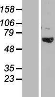 Western blot validation of overexpression lysate (Cat# LY424345) using anti-DDK antibody (Cat# TA50011-100). Left: Cell lysates from un-transfected HEK293T cells; Right: Cell lysates from HEK293T cells transfected with RC218610 using transfection reagent MegaTran 2.0 (Cat# TT210002).