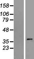 Western blot validation of overexpression lysate (Cat# LY412963) using anti-DDK antibody (Cat# TA50011-100). Left: Cell lysates from un-transfected HEK293T cells; Right: Cell lysates from HEK293T cells transfected with RC205831 using transfection reagent MegaTran 2.0 (Cat# TT210002).