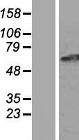 Western blot validation of overexpression lysate (Cat# LY404125) using anti-DDK antibody (Cat# <a href = "https://www.origene.com/catalog/antibodies/tag-antibodies/ta50011-100-clone-oti4c5-anti-ddk-flag-monoclonal-antibody" title="TA50011-100" class="">TA50011-100</a>). Left: Cell lysates from un-transfected HEK293T cells; Right: Cell lysates from HEK293T cells transfected with <a href = "https://www.origene.com/catalog/cdna-clones/expression-plasmids/rc222356-gpr152-nm-206997-human-tagged-orf-clone" title="RC222356" class="">RC222356</a> using transfection reagent MegaTran 2.0 (Cat# <a href = "https://www.origene.com/catalog/others/transfection-reagents/tt210002-megatran-20-plasmid-dna-transfection-reagent-05-ml" title="TT210002" class="">TT210002</a>).