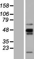 Western blot validation of overexpression lysate (Cat# LY423499) using anti-DDK antibody (Cat# TA50011-100). Left: Cell lysates from un-transfected HEK293T cells; Right: Cell lysates from HEK293T cells transfected with RC207835 using transfection reagent MegaTran 2.0 (Cat# TT210002).