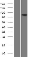 Western blot validation of overexpression lysate (Cat# LY414824) using anti-DDK antibody (Cat# TA50011-100). Left: Cell lysates from un-transfected HEK293T cells; Right: Cell lysates from HEK293T cells transfected with RC206073 using transfection reagent MegaTran 2.0 (Cat# TT210002).